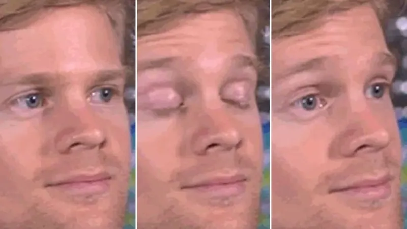 Blinking White Guy
